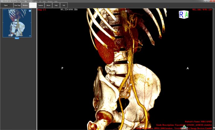 ORPALIS DICOM Viewer Free