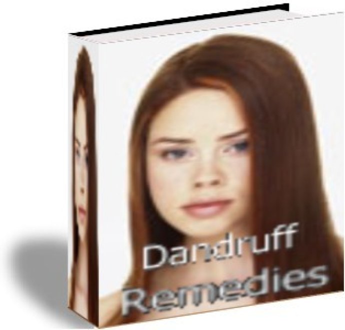 Dandruff Remedies